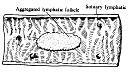 ILEUM.gif