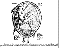 foetus3.gif