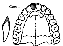 teethcrown.gif