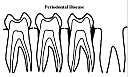 toothperiodontal.gif